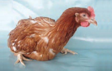 bệnh còi xương 