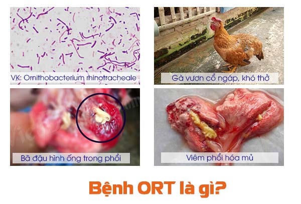 bệnh ort