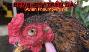 bệnh apv