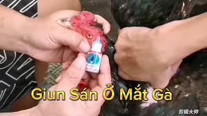 sán mắt gà